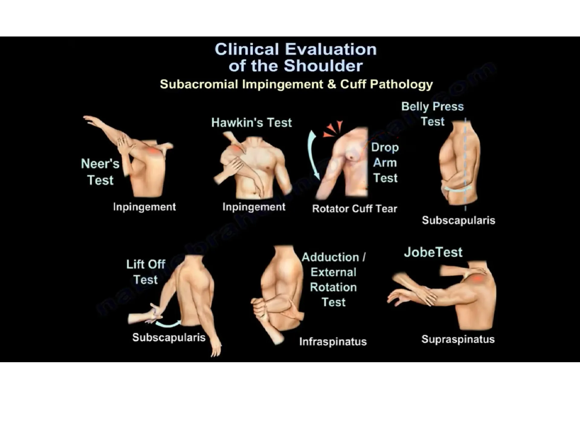 Shoulder Pain Diagnosis Chart